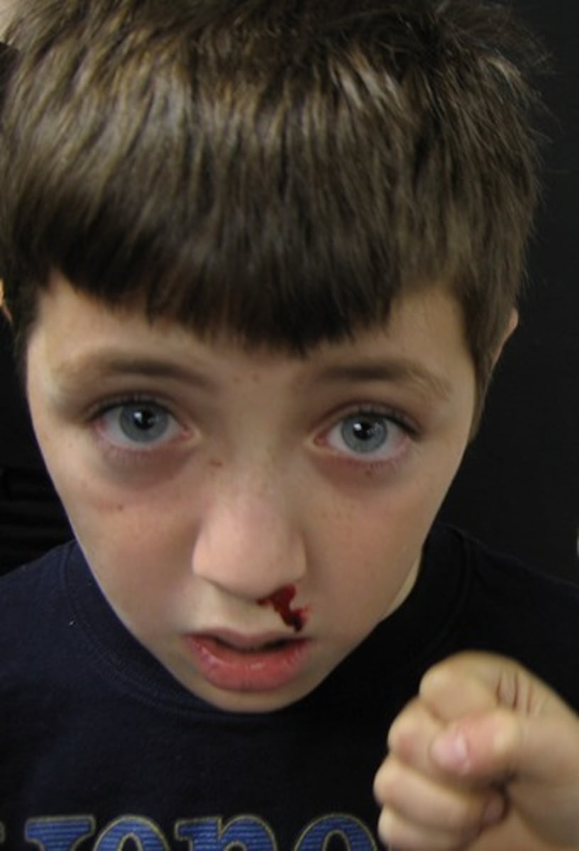 <p>These nurses specialize in caring for patients with blood disorders</p>