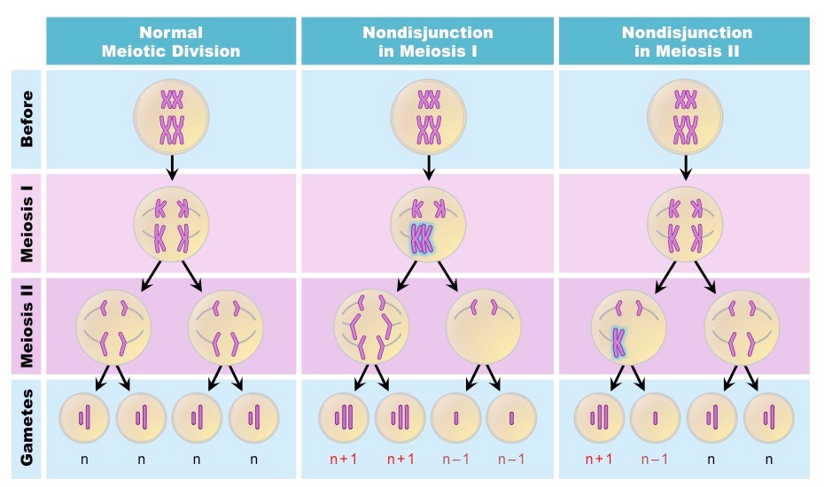 <p>Nondisjunction in Meiosis 1</p>