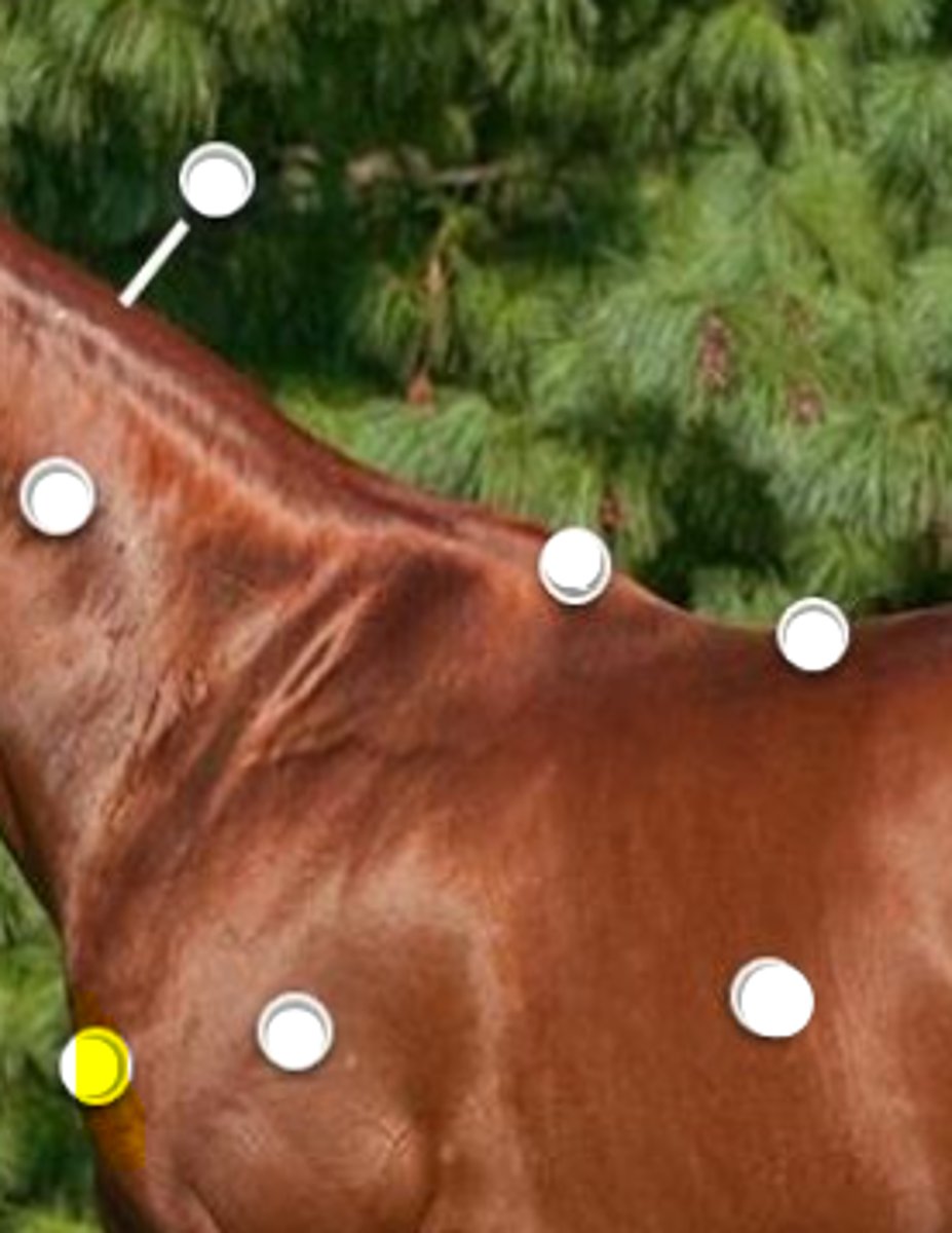 <p>What is body part is indicated on the image</p>