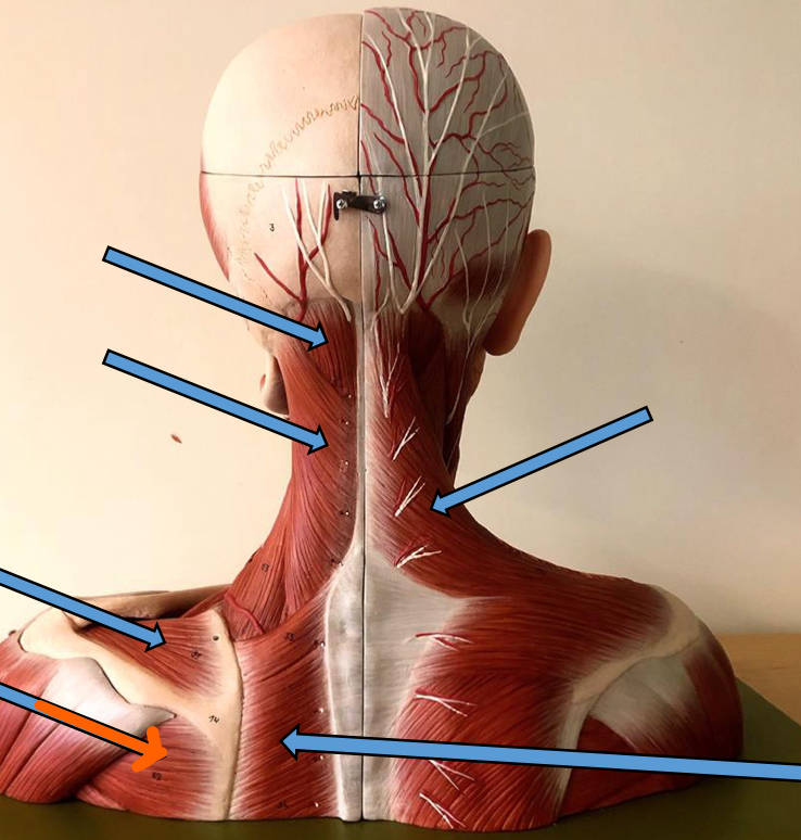 <p>Identify this muscle?</p>