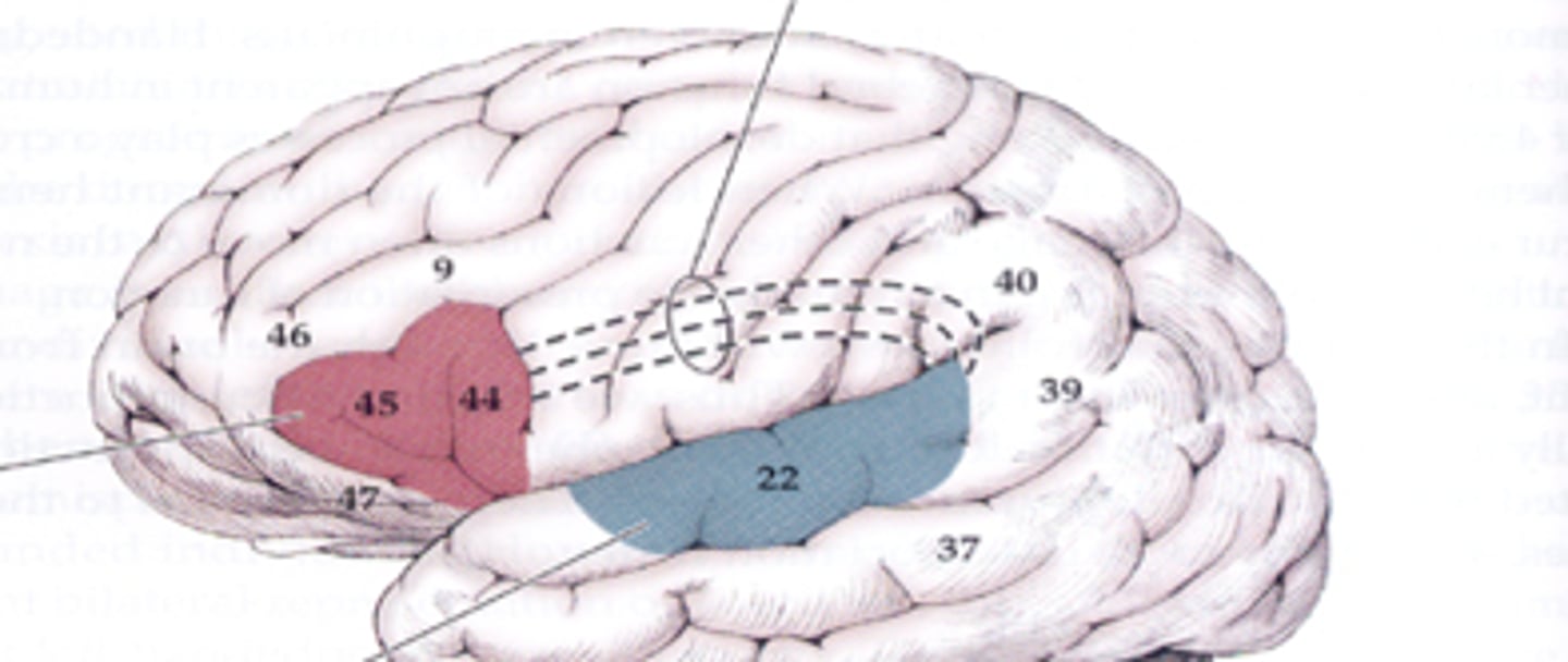<p>A: Caused by damage to the arcuate fasciculus, it results in fluent speech with many errors, impaired repetition, but intact comprehension.</p>