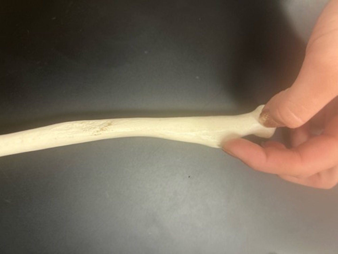 <p>name the bone</p>