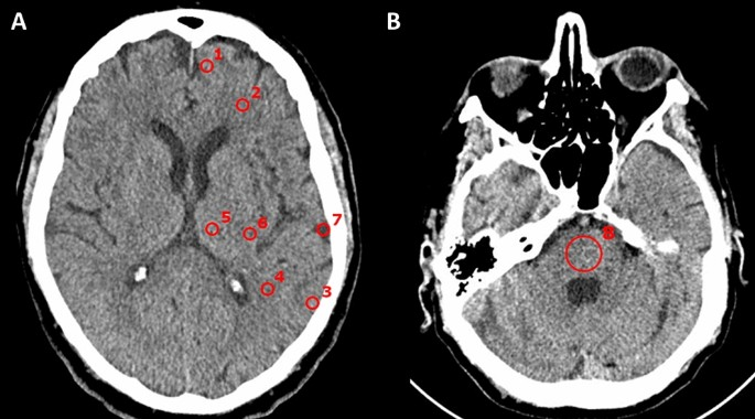 <p>What method of studying the brain is this?&nbsp;</p>