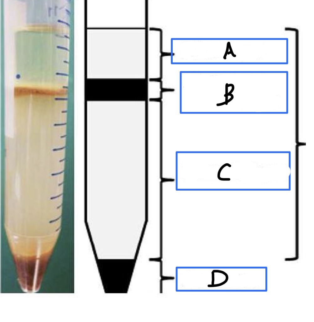 <p>A- what is the method of examination used here</p><p>B-identify the technique</p><p>C- Identify A,B,C,D in the picture</p><p>D- Used for what</p><p>E- <strong>Which layer contains the parasites for examination?</strong></p><p>F-<strong>Why can't this methods be used to detect Trophozoites?</strong></p>