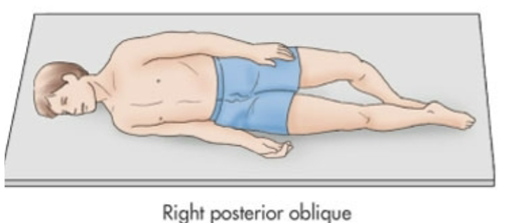 <p>Laying on right side but more tilted on their back</p>