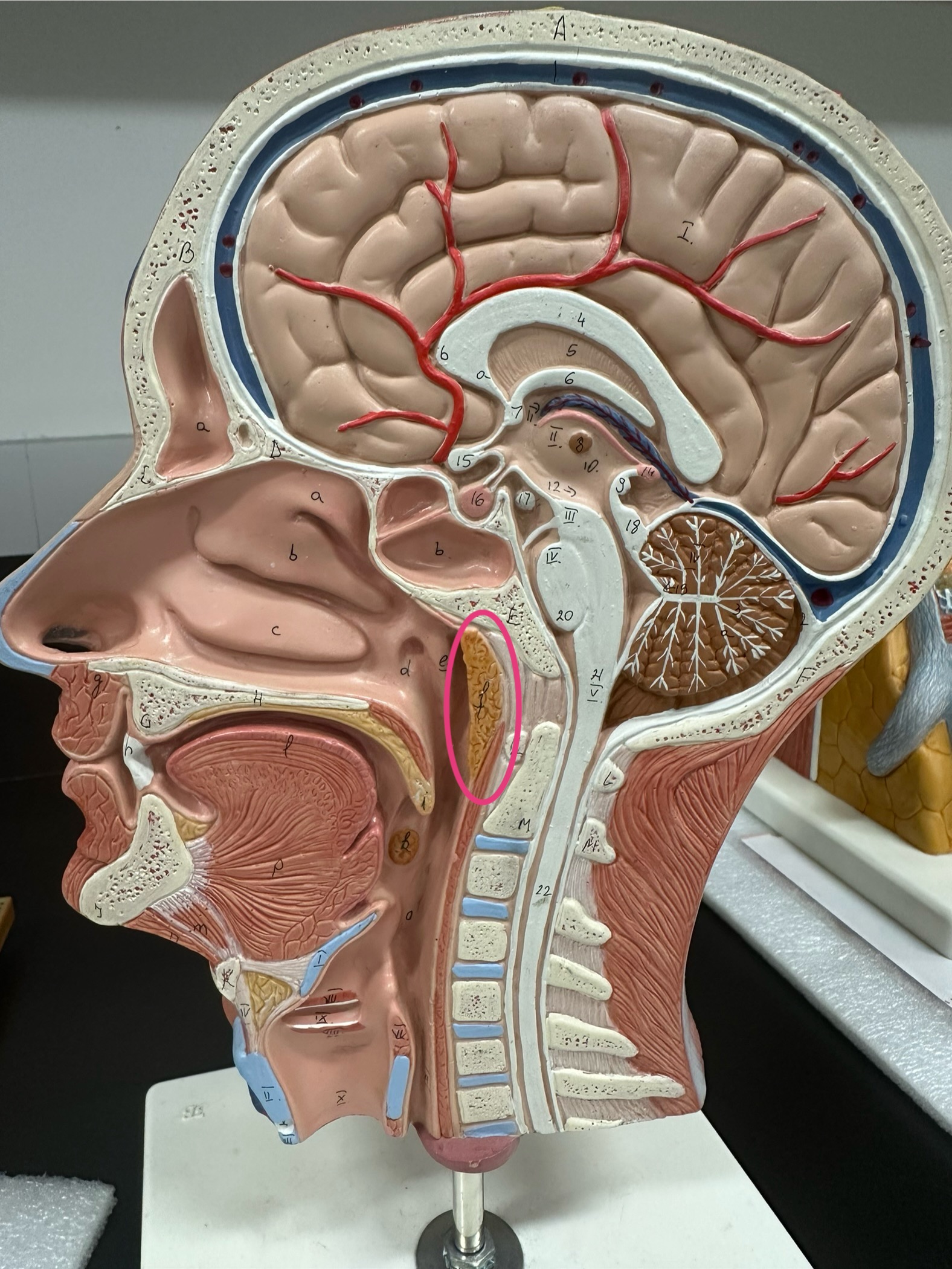 term image