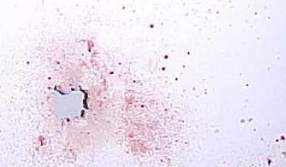 <p>Caused by a high velocity impact/force to a blood source such as that produced by gunshot or force resulting in the random dispersion of smaller drops of blood. (1 mm or smaller)</p>