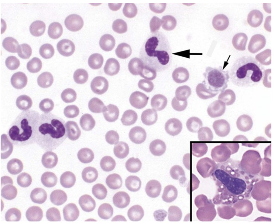 <p>The leukocytes found on this image are</p>