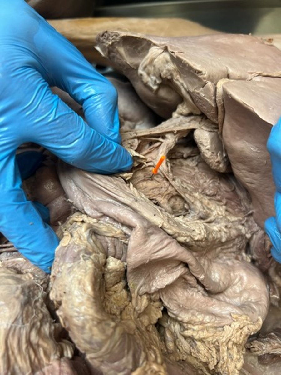 <p>coeliac trunk</p>