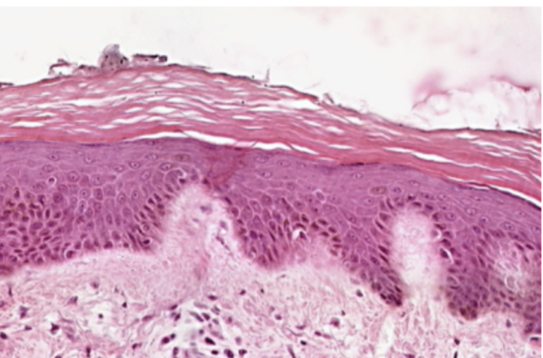 <p>What epithelium can be seen in this slide?</p>