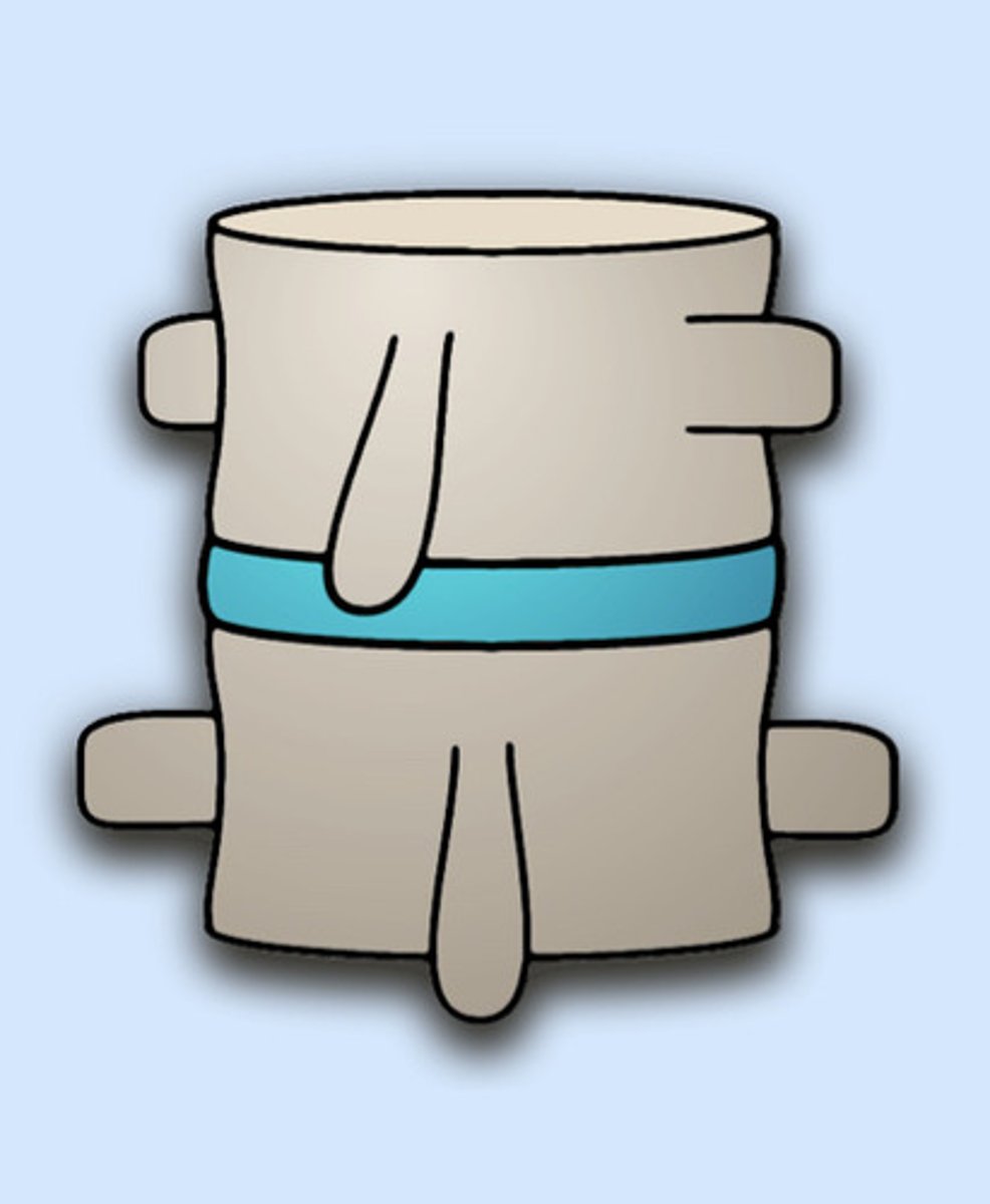 <p>Static listing</p>