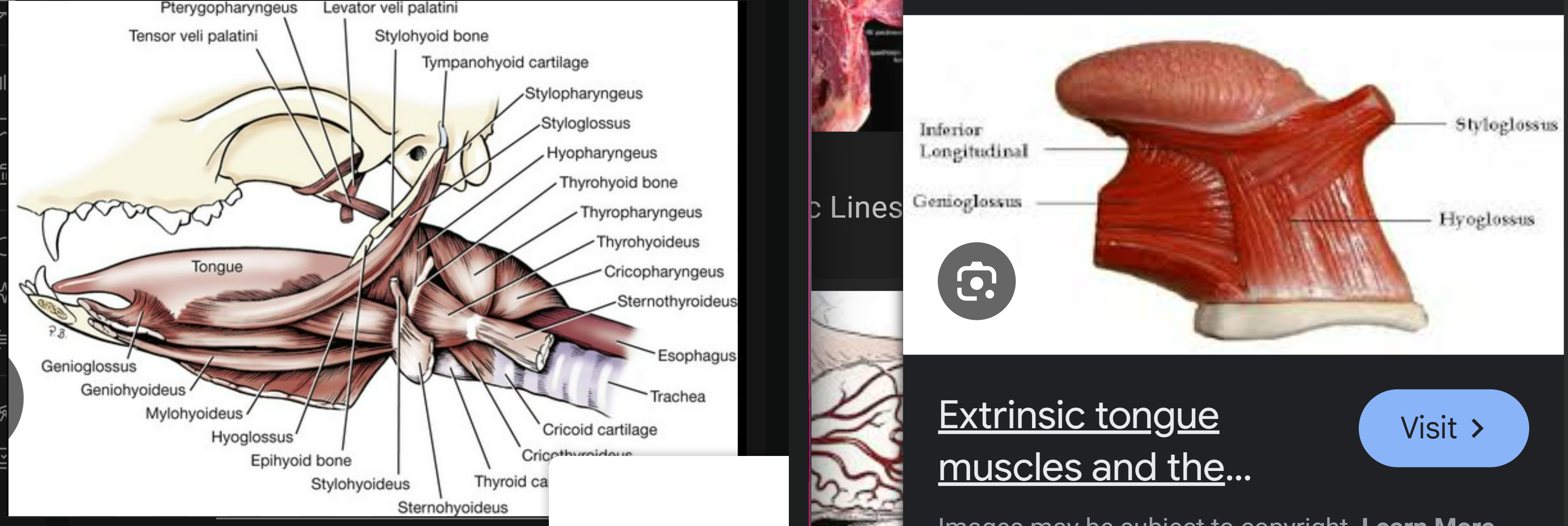 <ol><li><p>styloglossus m</p></li><li><p>hyoglossus m: runs from hyoid apparatus to root of tongue</p></li><li><p>-</p></li><li><p>-</p></li><li><p>-</p></li><li><p>-</p></li><li><p>thyrohyoideus</p></li></ol><p></p>