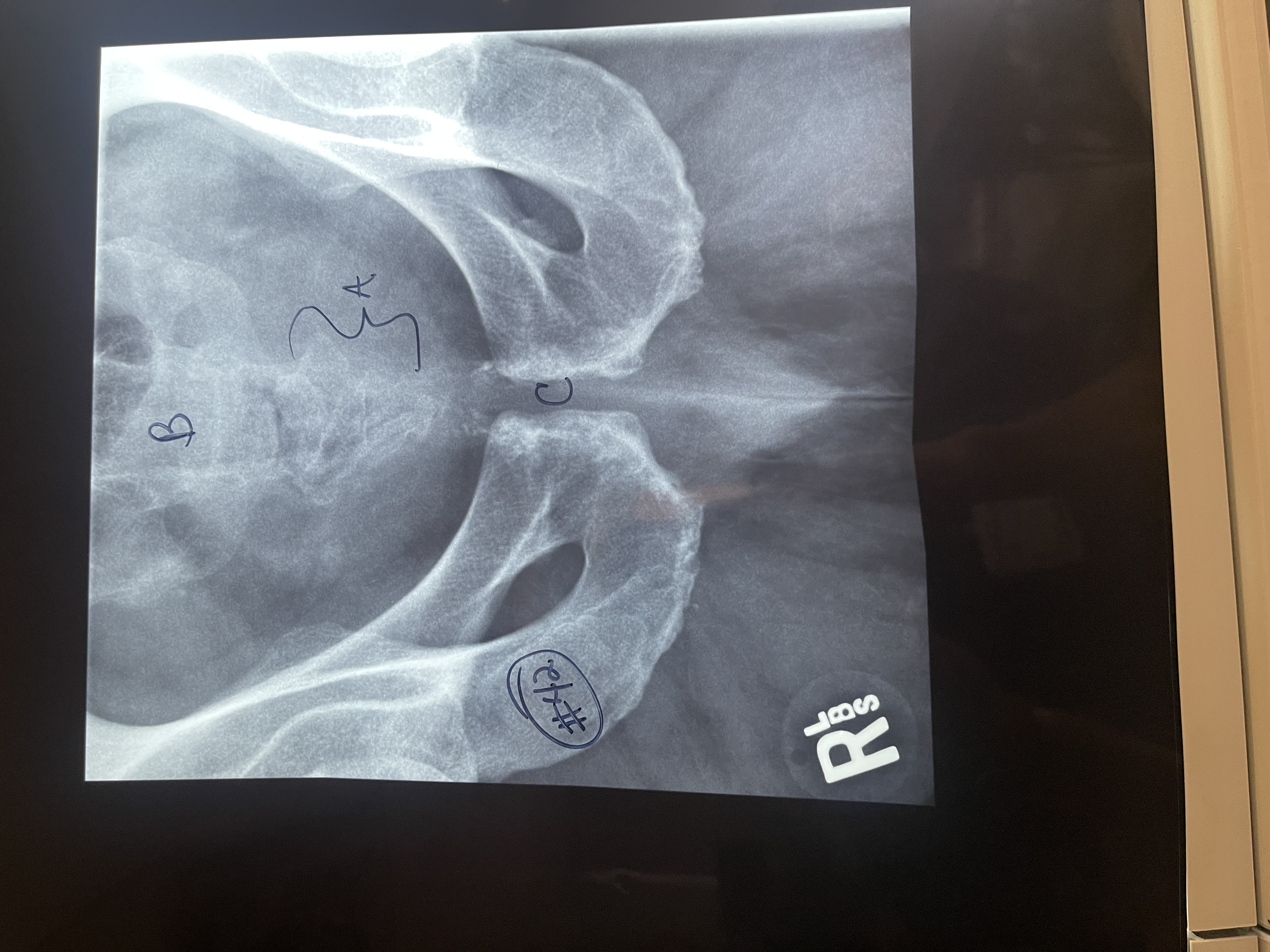 <p>Label # 42 AP axial sacrum</p>