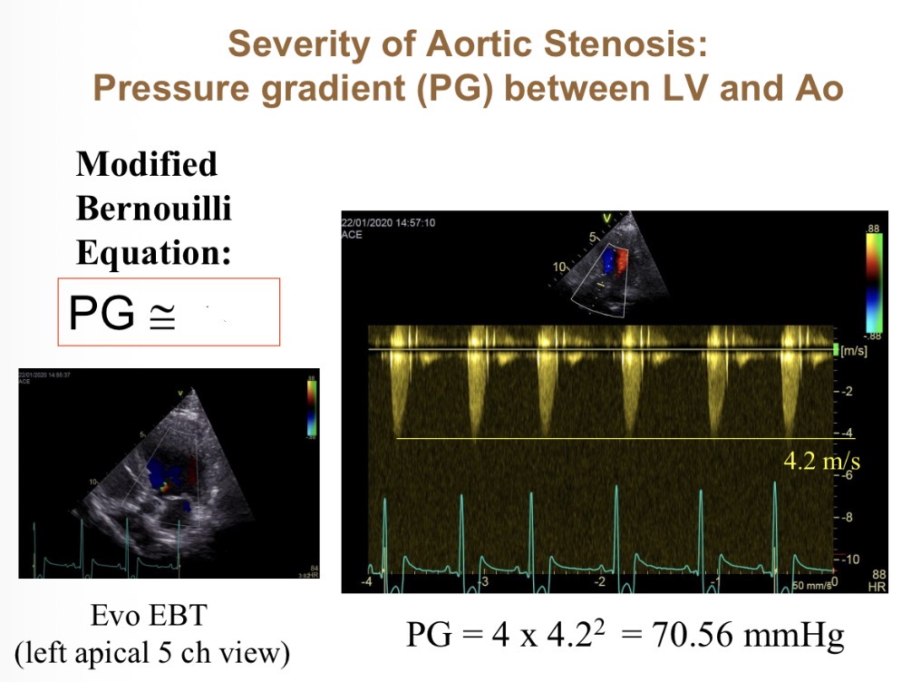 <p>How does pressure gradient vary with velocity (equation)</p>