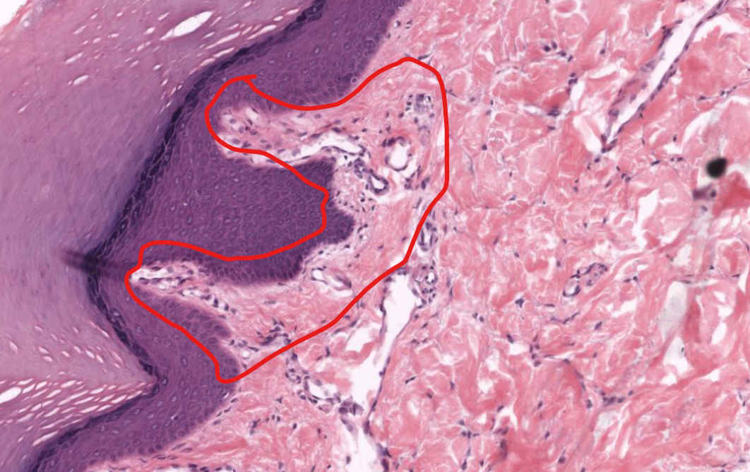 <p>(layer)</p>