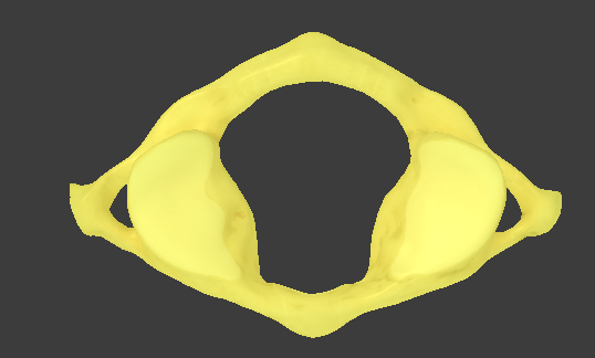 <ul><li><p>C1</p></li><li><p>superior articular facet that articulates with the occipital condyle</p></li><li><p>atlantooccipital joint</p></li></ul><p></p>