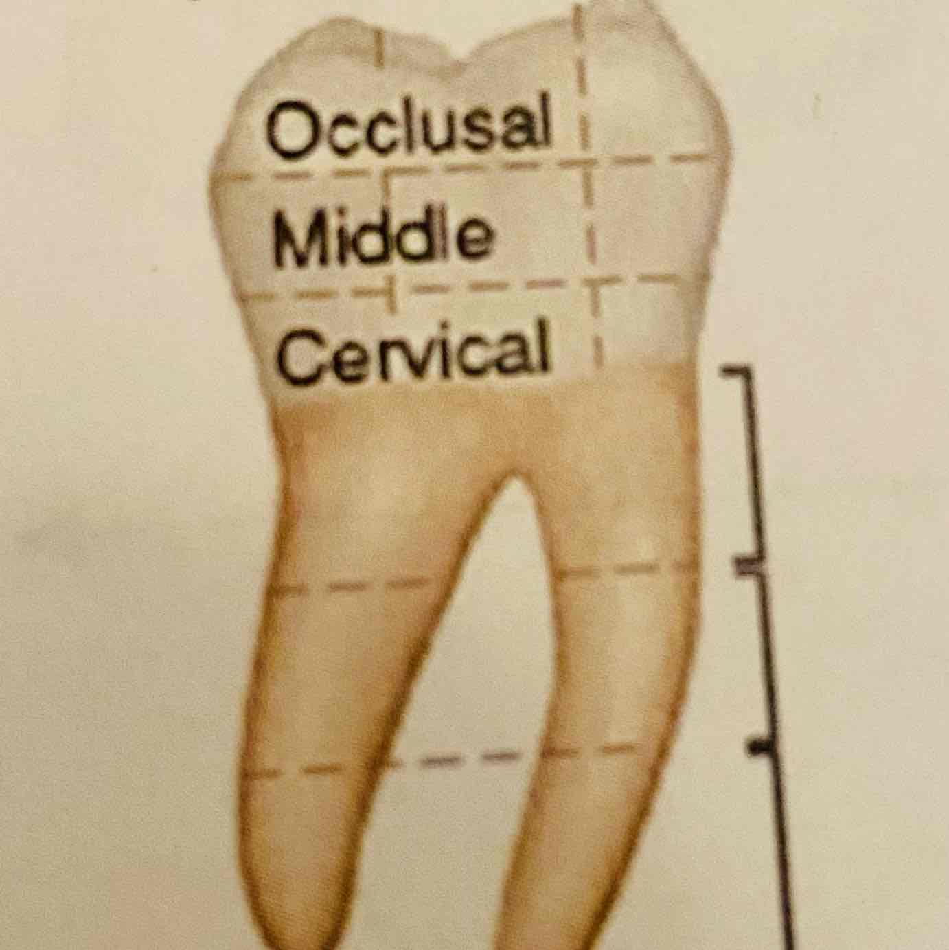 <ul><li><p>Occlusaal</p></li><li><p>Midden</p></li><li><p>Cervicaal</p></li></ul>
