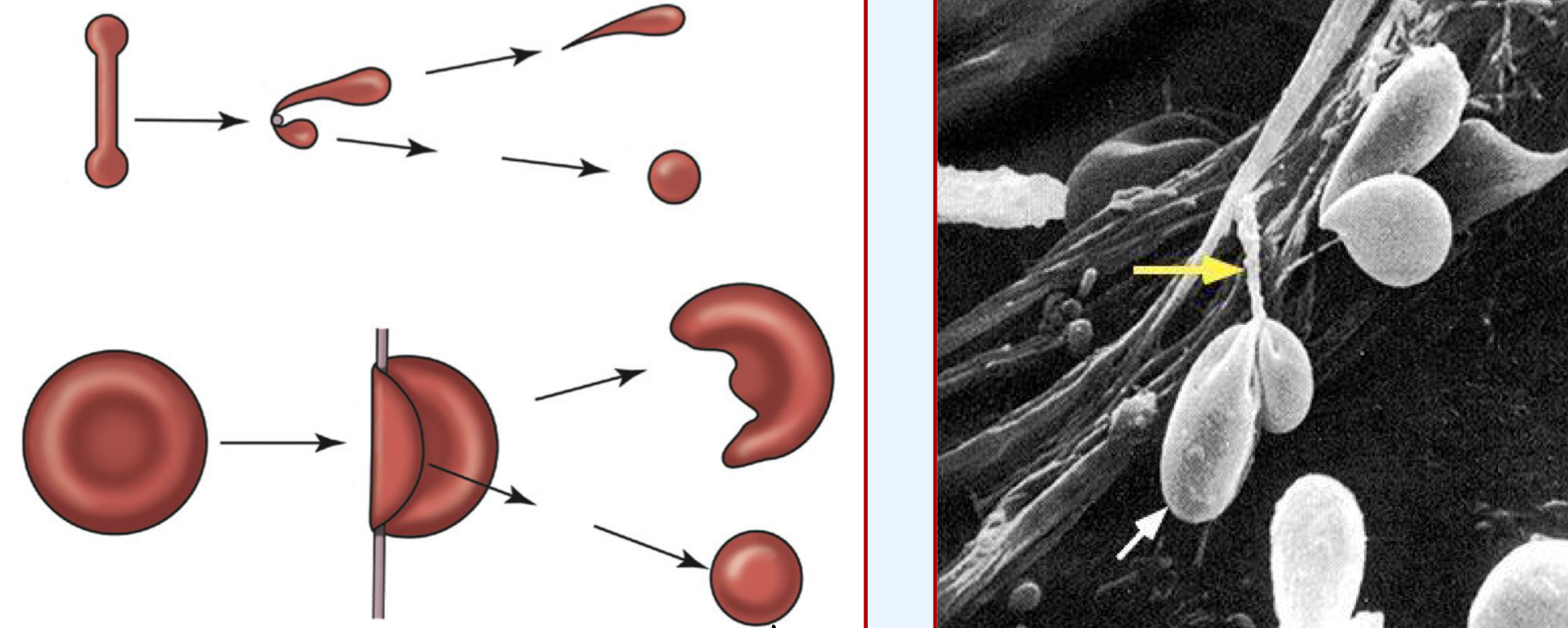 <ul><li><p>Hemangiosarcoma</p></li><li><p>Intravascular coagulation</p></li><li><p>Vasculitis</p></li><li><p>Hepatic disease</p></li><li><p>Caval syndrome of dirofilaria, endocarditis, heart failure</p></li><li><p>Iron deficiency </p></li></ul><p></p>