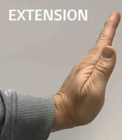 <p>Bending your wrist backwards with your palm up, as when throwing a ball or doing push-ups.</p>