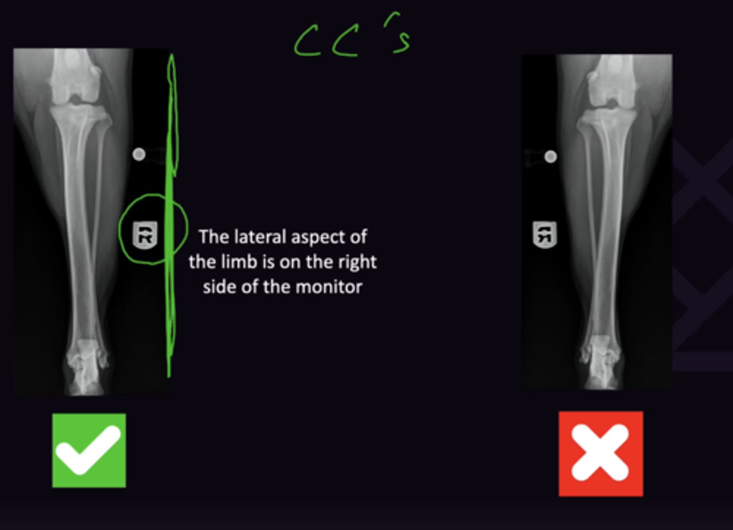 <p>1. Lateral aspect of limb always on the right side of the monitor (marker should always be on the right hand side of the monitor)</p>