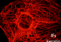 <ol><li><p><span>their functions are primarily mechanical and as a class, intermediat filaments are less dynamic than actin filaments or microtubules.&nbsp;</span></p><ol><li><p><span>Commonly work in tandem with microtubules, providing strength and support for the fragile tubulin structures.</span></p></li></ol></li></ol><p></p>
