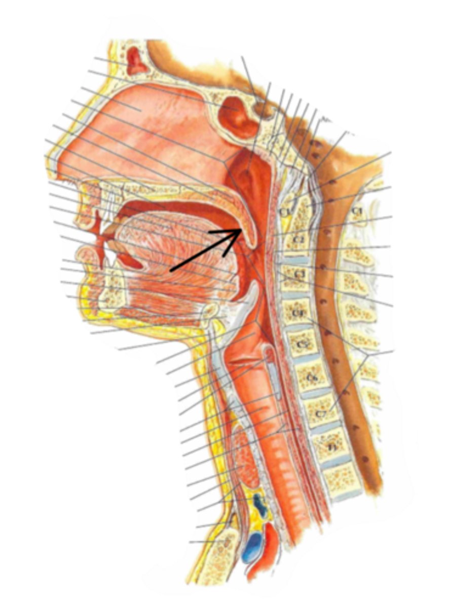<p>Identify the structure indicated by the arrow</p>