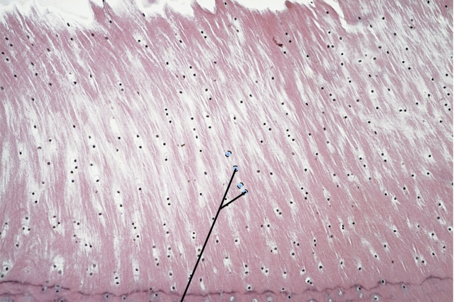 <p>What is the arrow point at?</p>