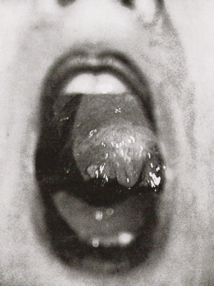 term image