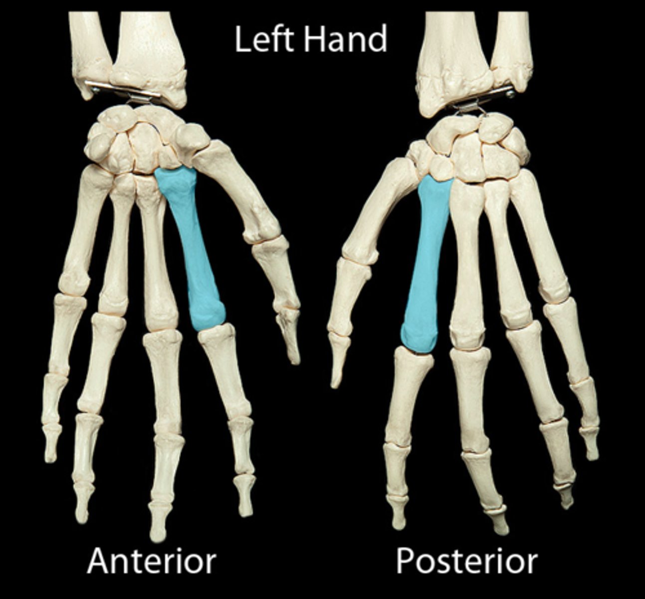 <p>What number is this metacarpal</p>