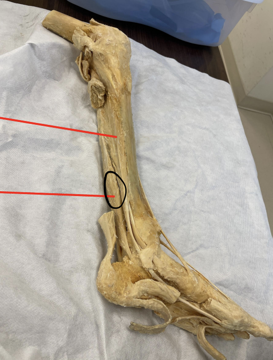 <p>identify + state origin, insertion, action, innervation of marked structure</p>