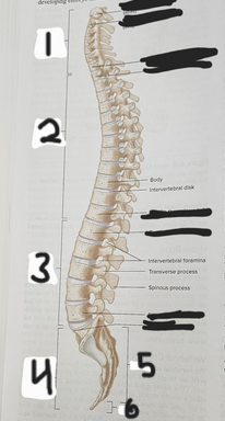 <p>What is structure #3?</p>