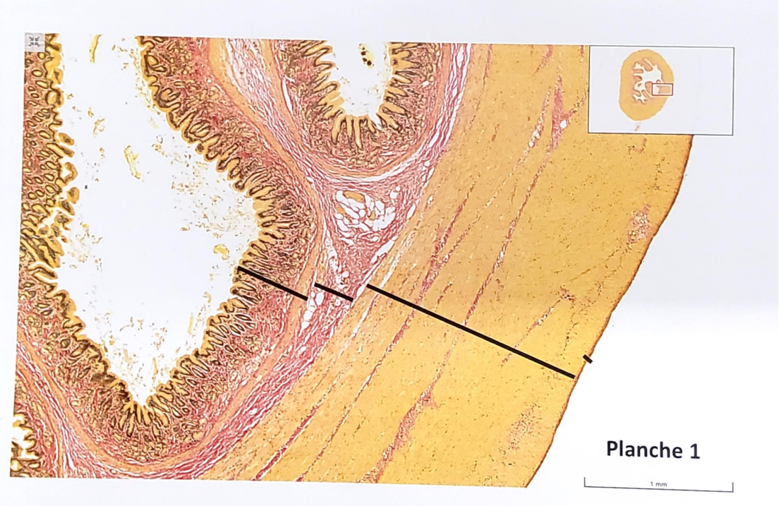 * **Tunica mucosa** (Lamina epithelialis, enlaget cylinder epithel, Lamina propria – irregulært bindevæv med blodog lymfekar/chylus ampul, postgangl nervefibre, glatte muskelceller, lamina muscularis mucosae, circulært orienteret lag af glat muskulatur),
* **Tela submucosa** (irregulært bindevæv med blod og lymfekar, præ- og post ganglionære nerve fibre, ganglion – plexus submucosus) ,
* **Tunica muscularis** (Fibrae oblique, Stratum circulare, Stratum longitudinale), lag af glat muskulatur samt ganglion/plexus myentericus imellem stratum circulare og long.,
* **Tunica serosa**, enlaget pladeepithel, tela subserosa, bindevæv, kar, nerver