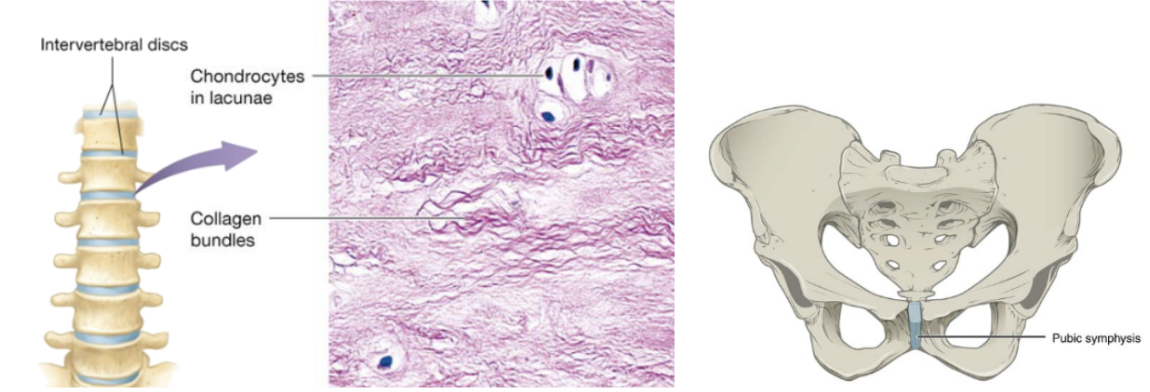 <p>cartilage with tensile strength with the ability to absorb compressive shock</p>