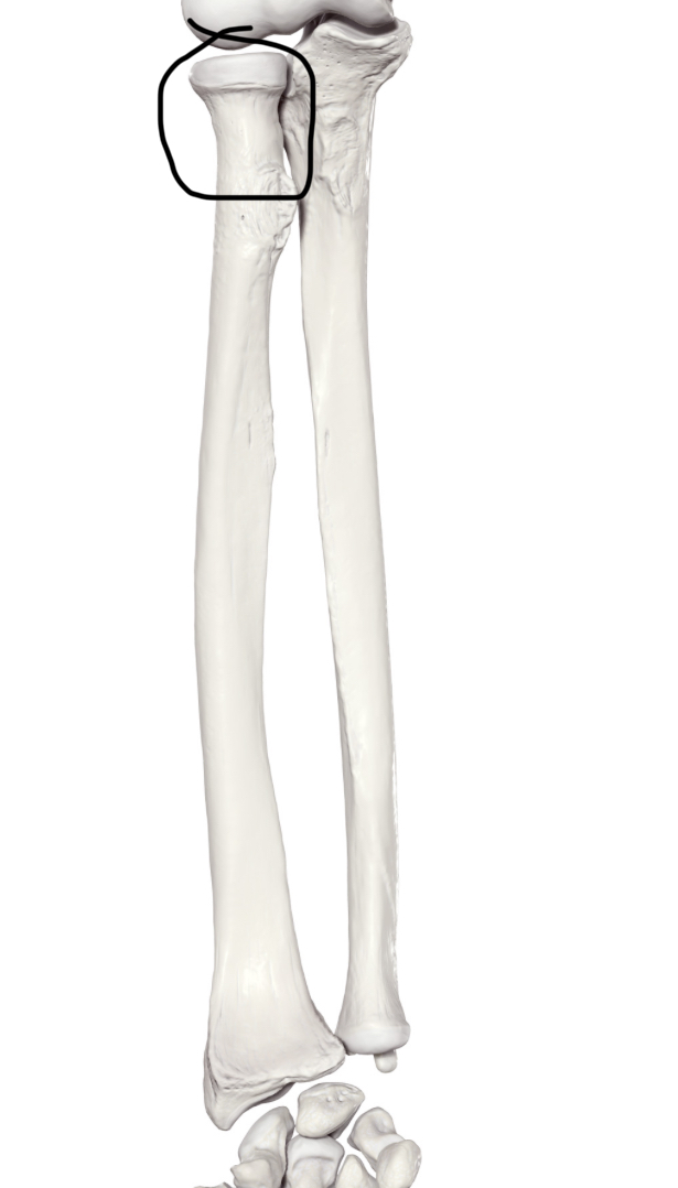 <p>Hoe heet dit deel?</p>