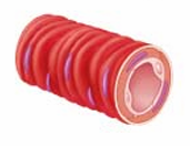 <p>Arterioles</p>