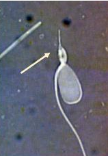 <p>Identify the sperm morphology.</p>