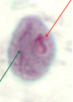 <p>What is at green arrow? (1)</p><p>What is at red arrow? (2)</p>