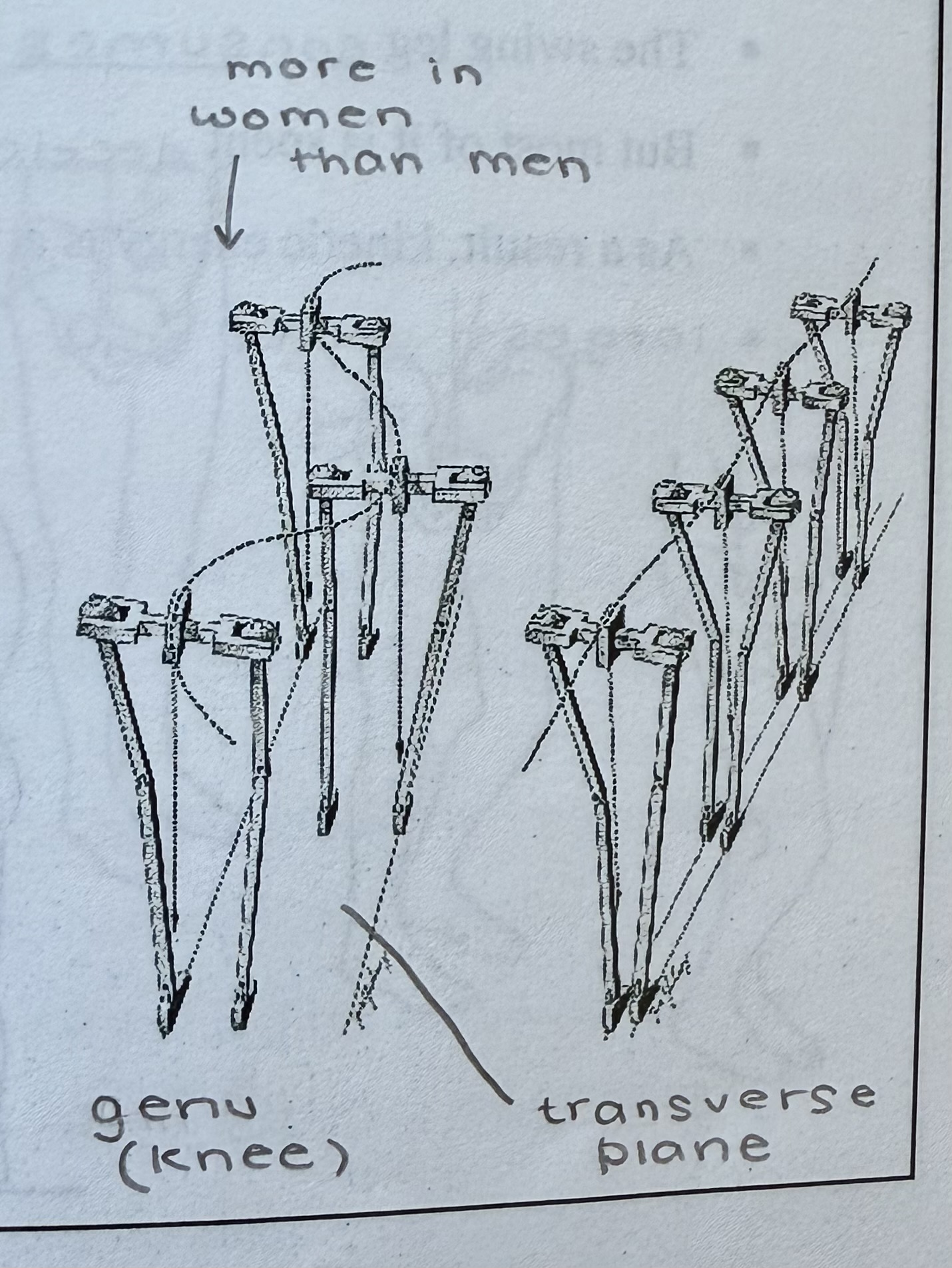 <ul><li><p>structural feature of the human knee joint</p></li><li><p>limits lateral movement in the body’s COG during the gait cycle</p></li></ul><p></p>