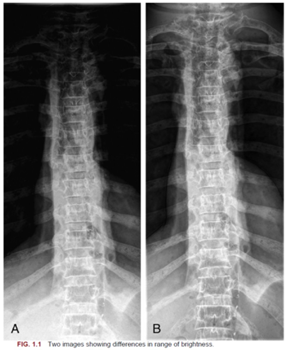 <p>30. Fig. 1.1 shows two images demonstrating differences in the range of brightness between anatomic structures of varying tissue densities. Compare these images and identify which image was exposed using a compensating filter and which image was exposed without a compensating filter. (The choices are "with filter" and "without filter.")</p>