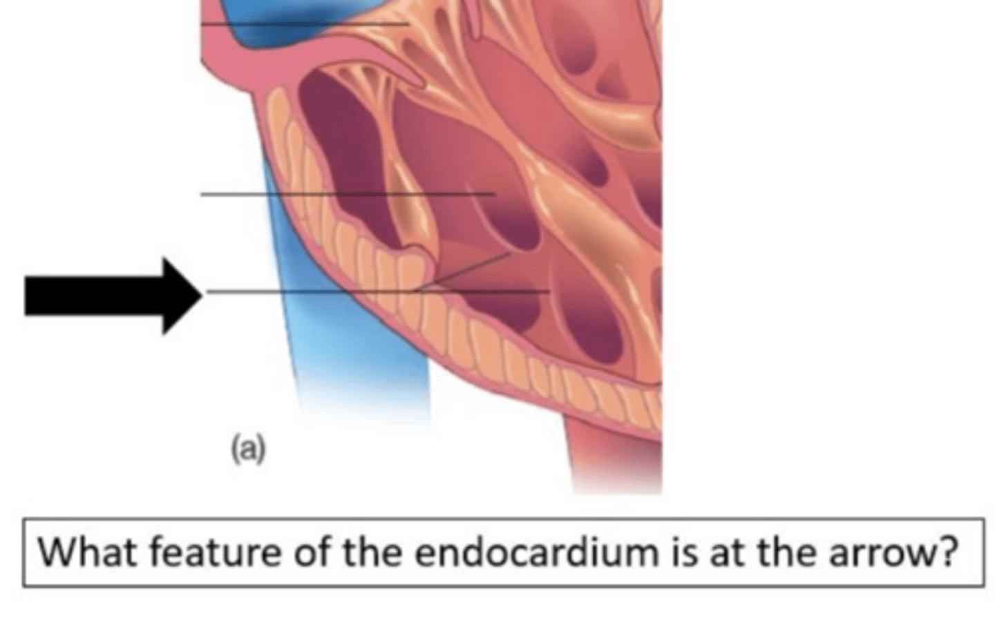 <p>What feature of the endocardium is at the arrow?</p>