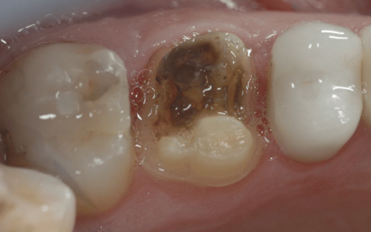 <p>What caused this defect?</p>