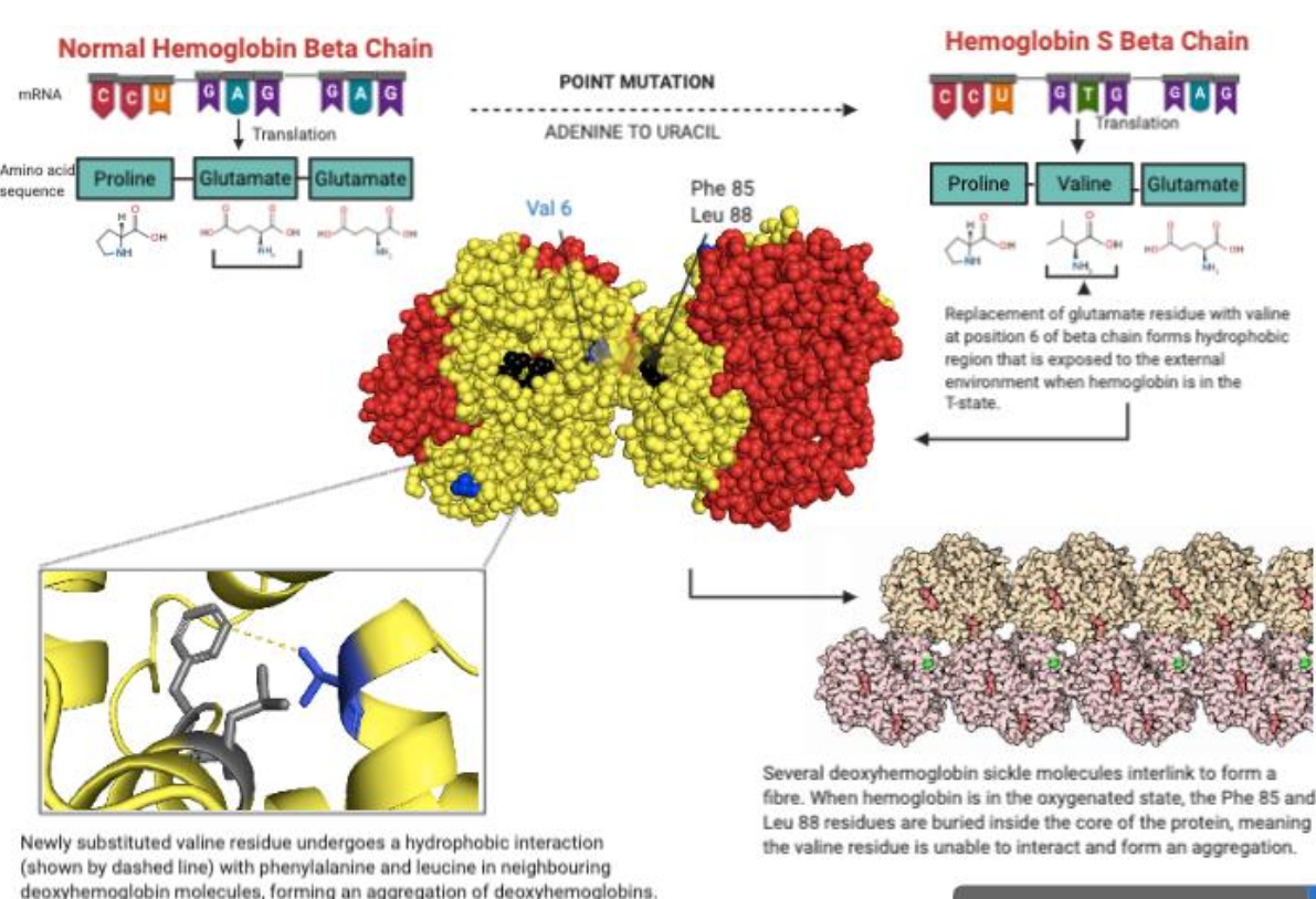 <p>point mutation of adenosine to uracil in haemoglobin beta subunit gene → replaces glutamate with valine → changes structure and function of haemoglobin<br>Victoria Gray - CRISPR therapy</p>