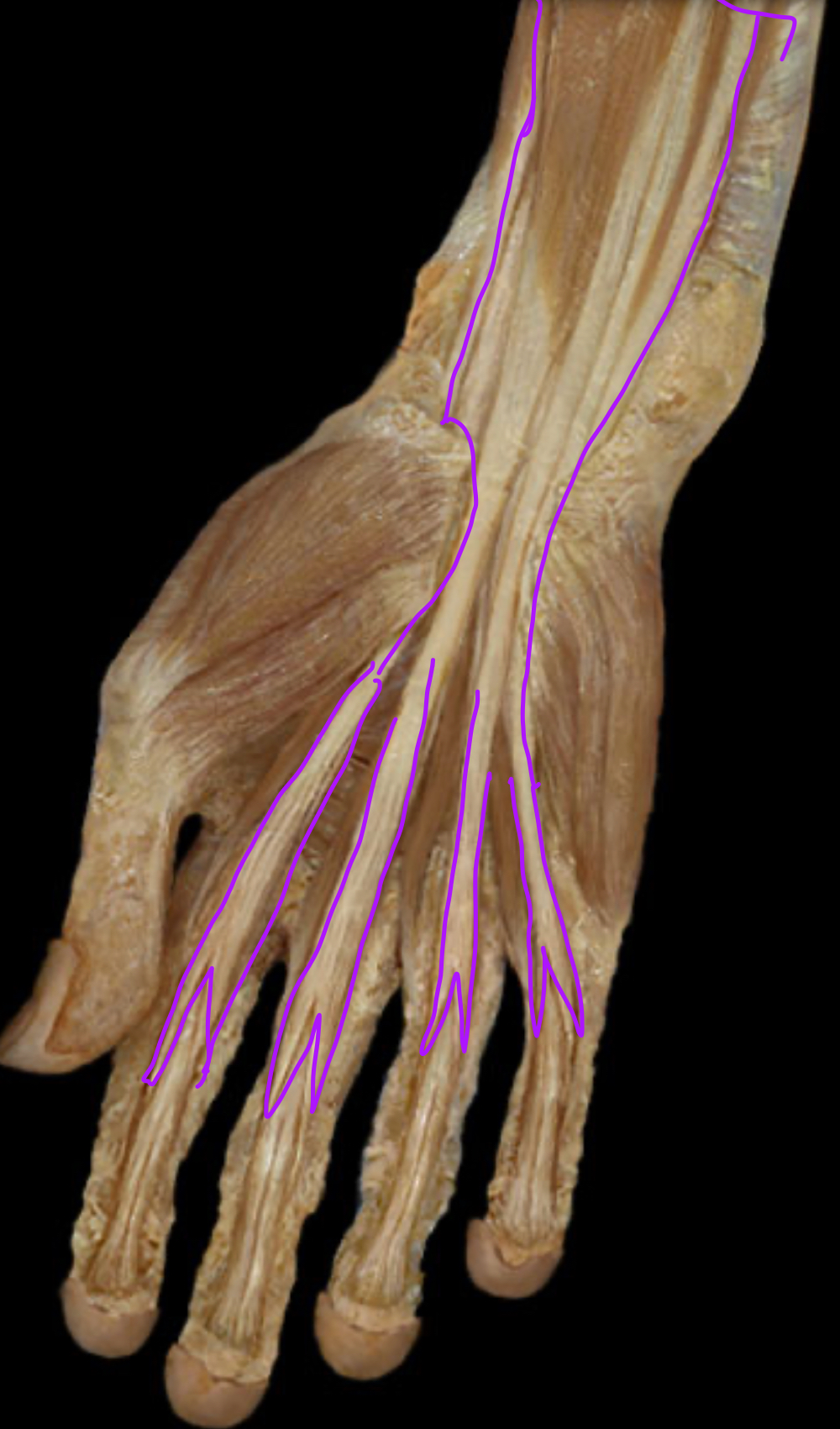 <p>Function?</p>
