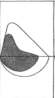 <p><span>The latter portion of the expiratory loop begins to take on a <mark data-color="yellow" style="background-color: yellow; color: inherit;">concave appearance</mark></span></p>