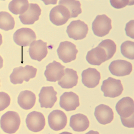 <p>What is the shape of this erythrocyte?</p>