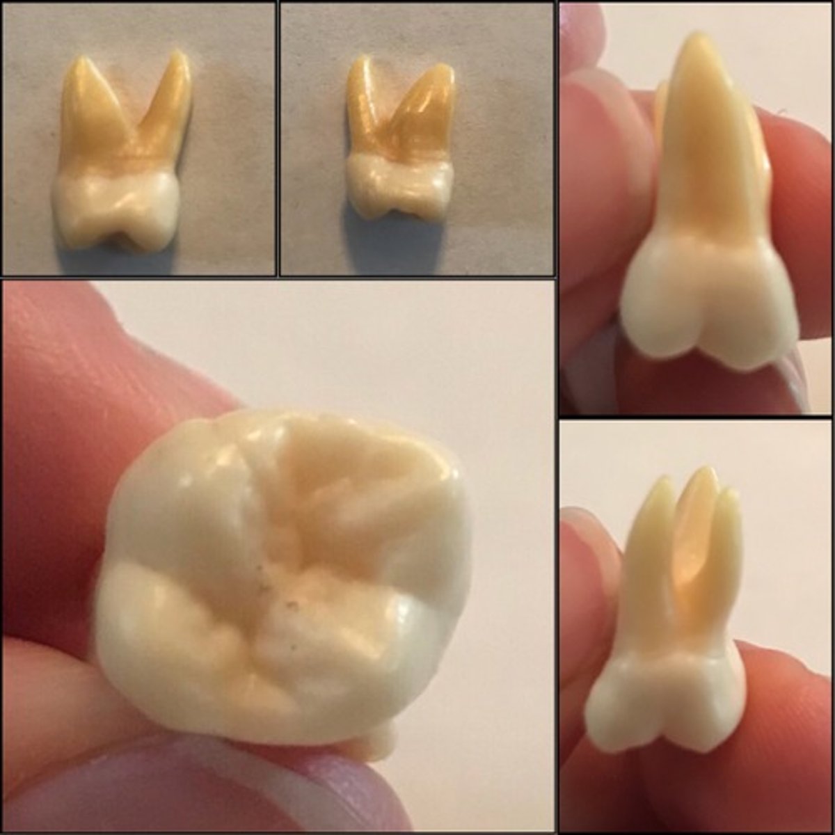 <p>What tooth is this ?</p>