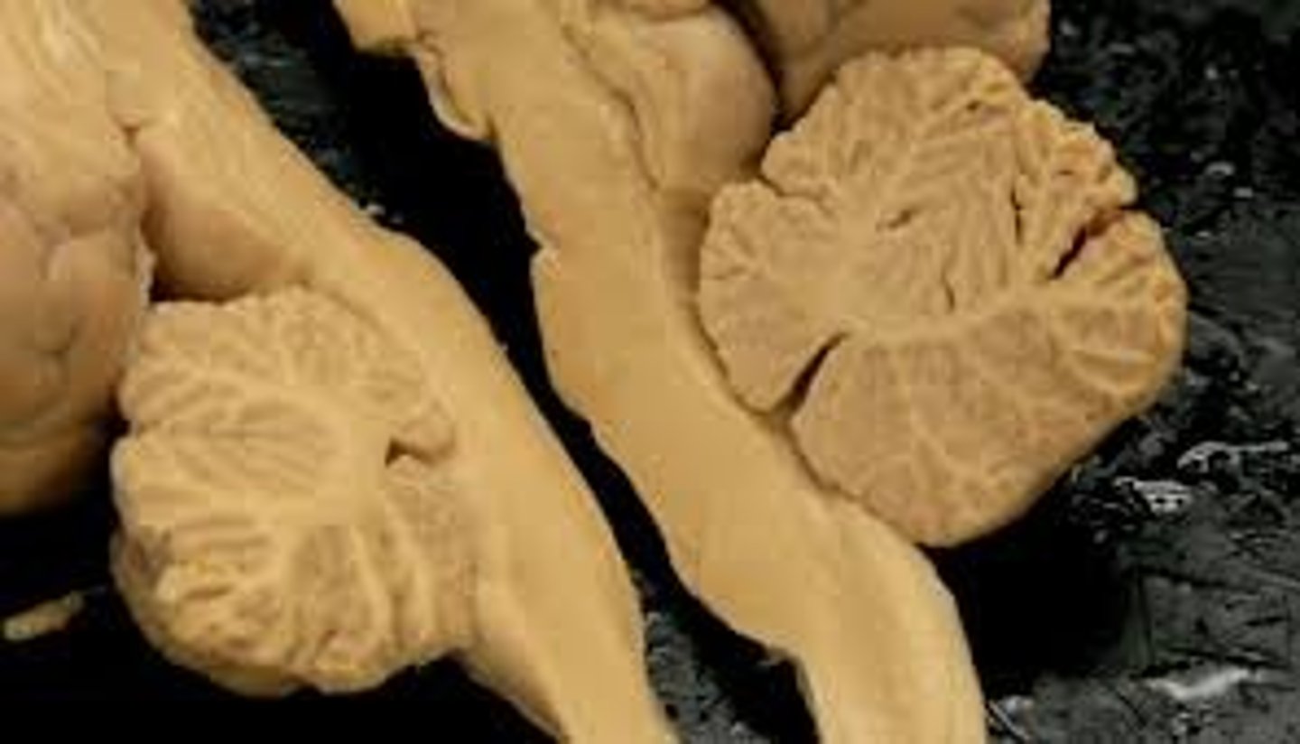<p>What is the white matter of the cerebellum called?</p>