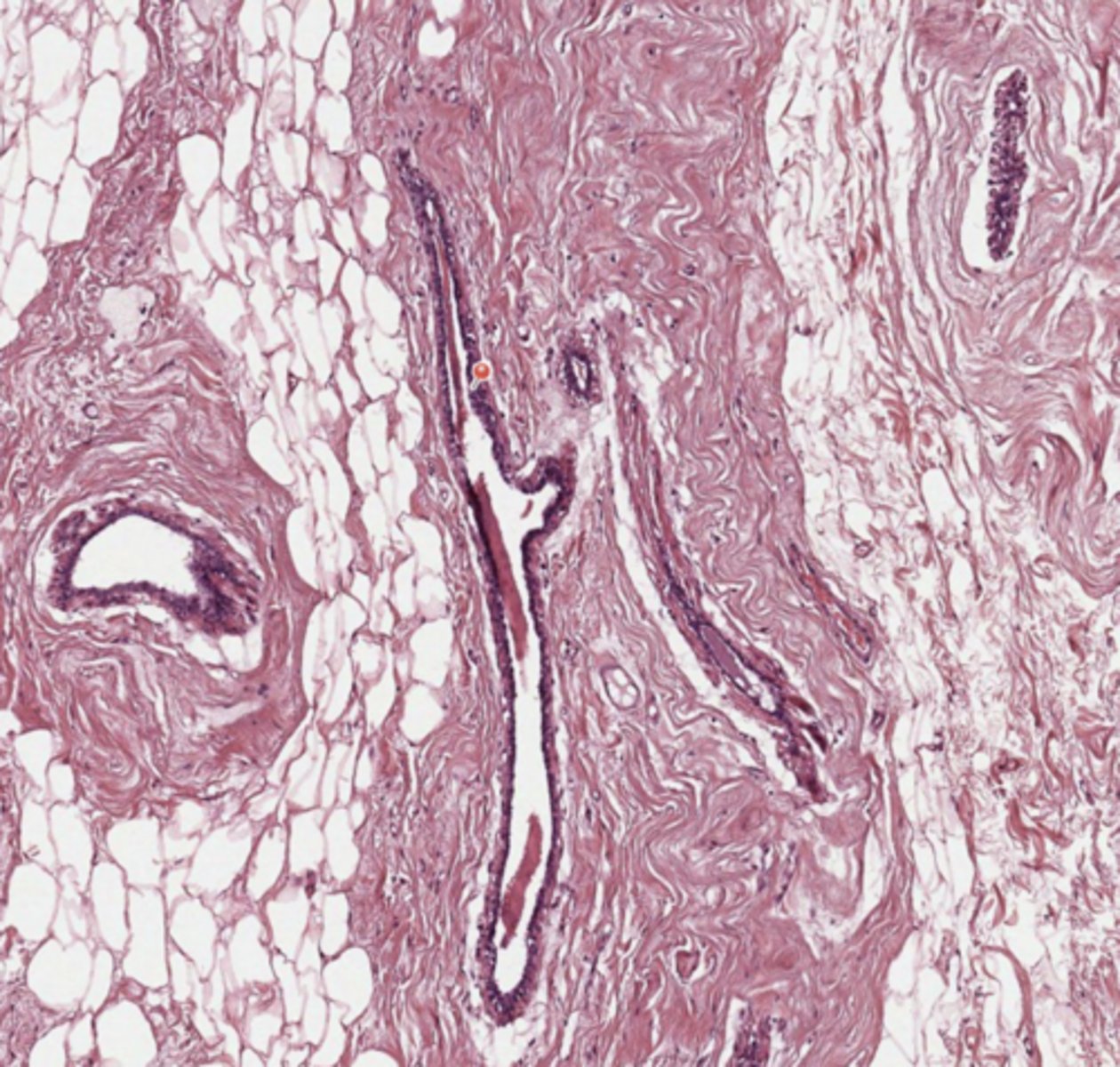 <p>Breast</p>