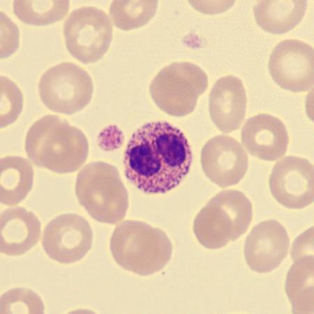 <p>What characteristics is this neutrophil showing?</p>