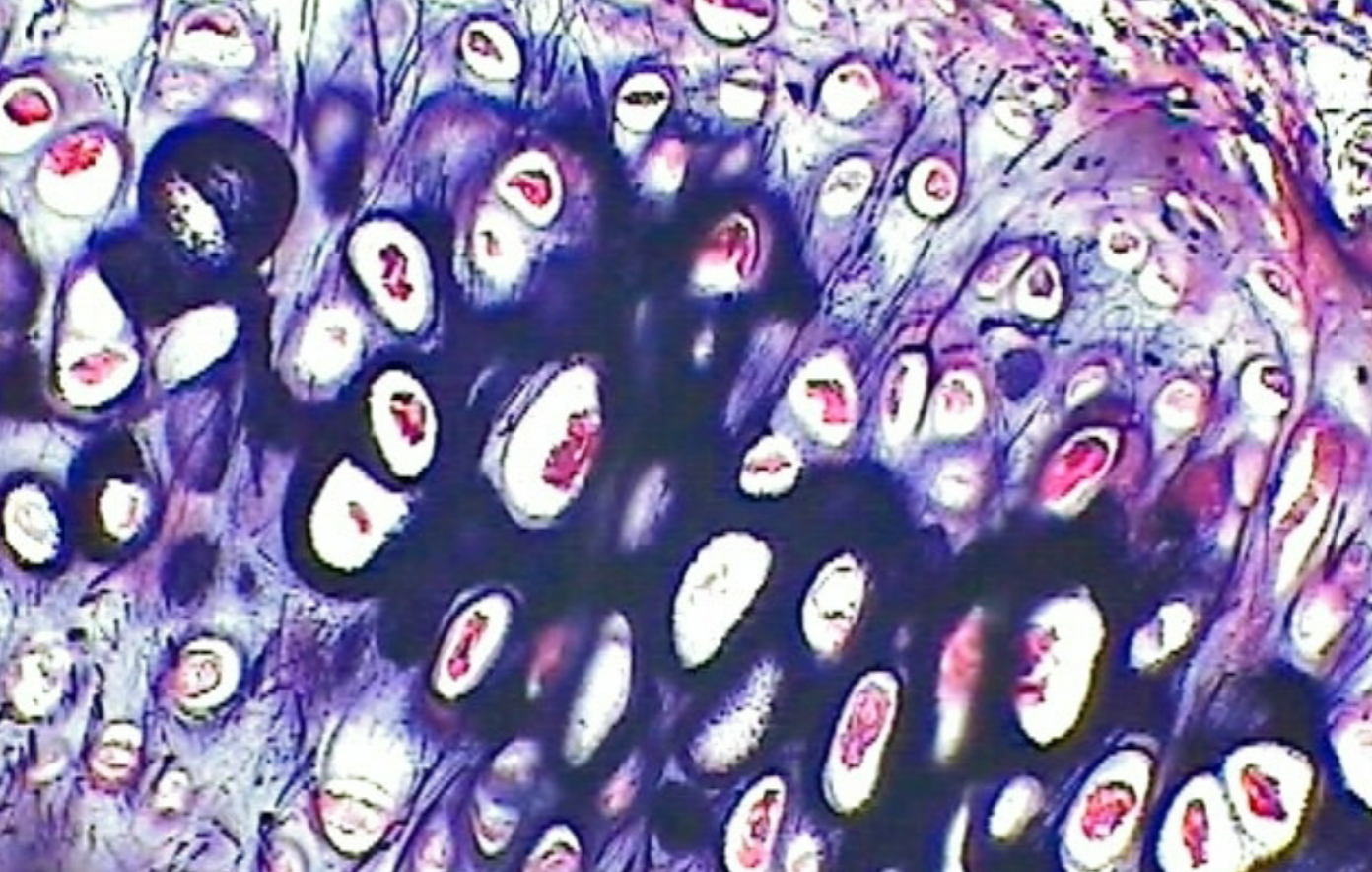 <p>Where are the Elastic Cartilages (connective tissue) found?</p>